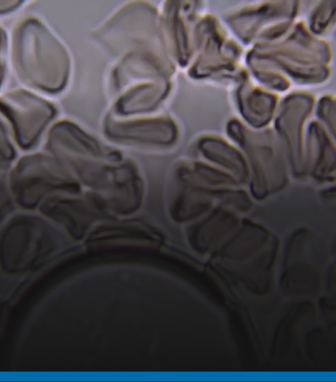 THE WORLD MOSQUITO PROGRAM